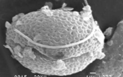 11: Què són les tècniques analítiques?