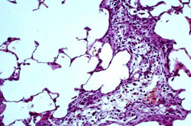 2: El misteri dels inicis