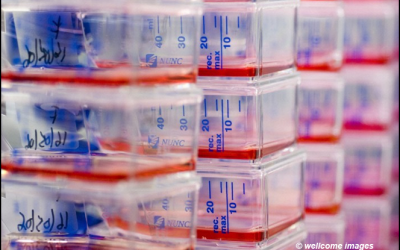 3: Què s'hi pot fer?