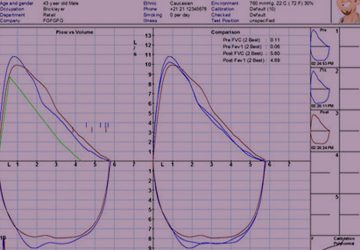 16: El seguiment i l'espera