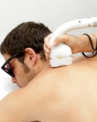 Depilació 'làser' i radiacions