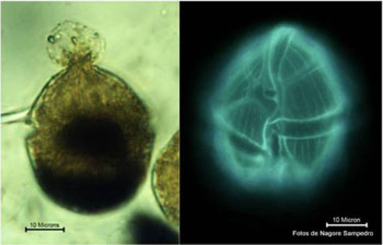 Fotografies preses amb microscopi òptic de camp clar i d’epifluorescència de G. fragilis. Nota el material viscós sortint de la part apical de la cèl•lula.