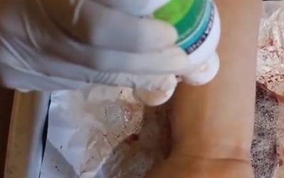 El fetge i l’aigua oxigenada