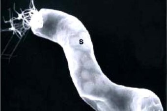 Titanospirillum velox, l'espiroqueta catalana