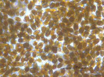 Proliferació d’Ostreopsis observada al microscopi òptic