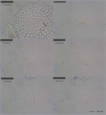 Diatomees sobre residus plàstics trobats al mar, observades amb microscopi. Fotografia d'E. Garcés.